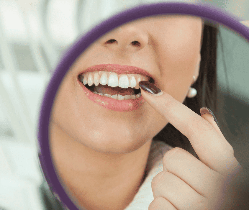 Usmievajúca sa žena ukazujúca biele zuby cez zväčšovacie sklo