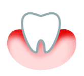 Grafika zobrazujúca biely zub na ružovom pozadí pripomínajúcom žuvačku.